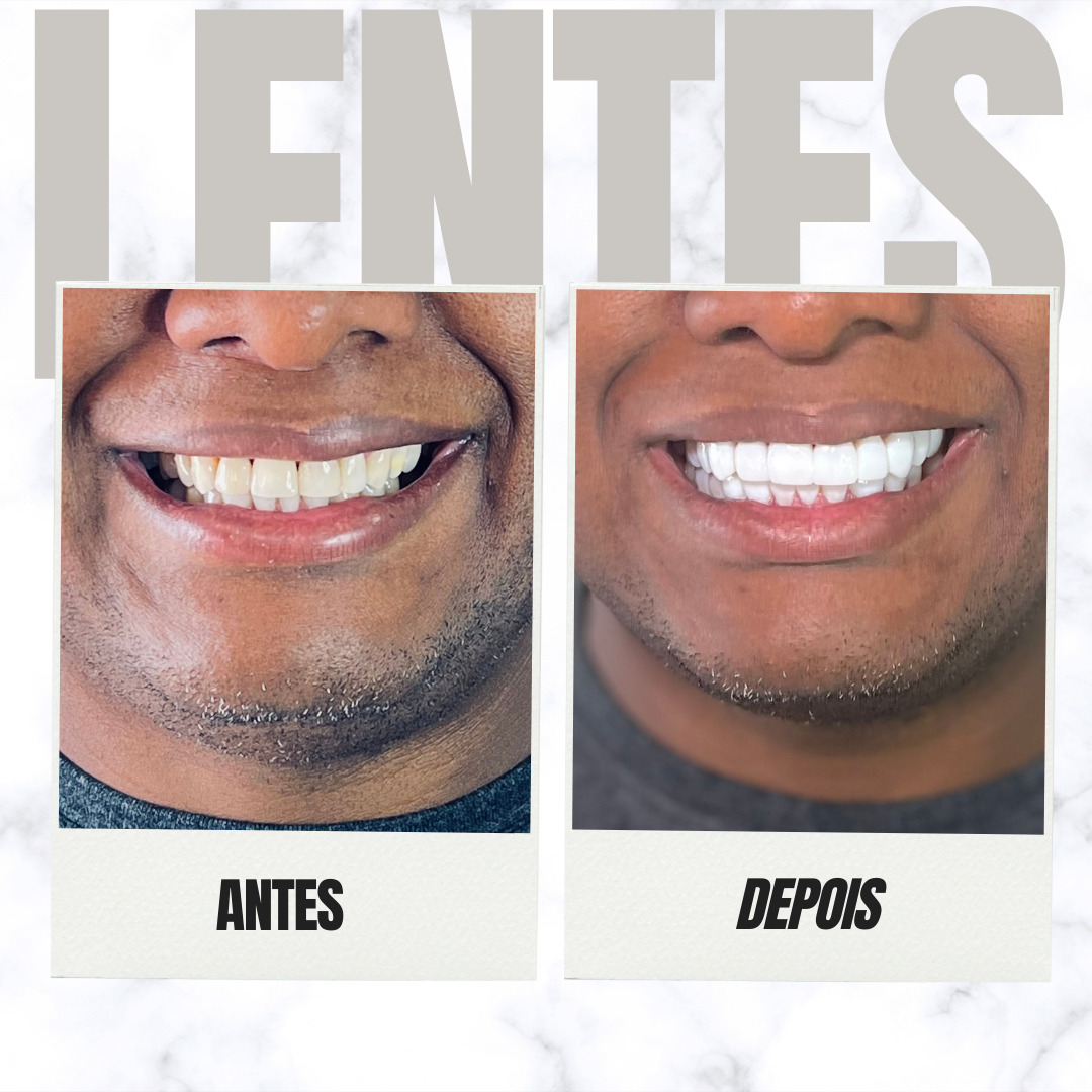 lentes - 21